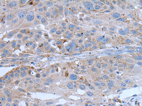 Rabbit Polyclonal Antibody to YPEL4