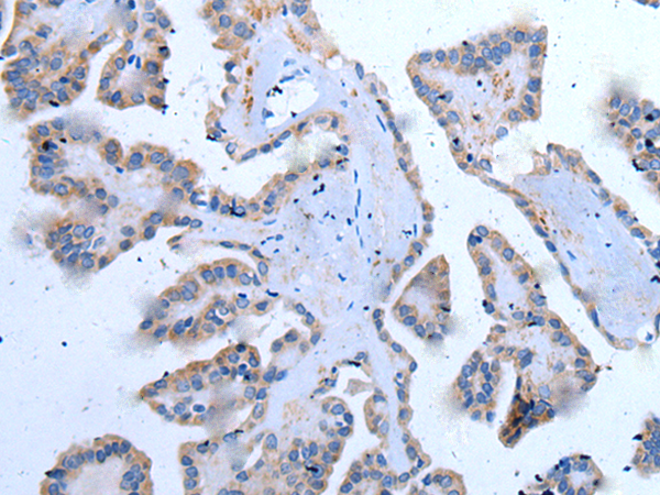 Rabbit Polyclonal Antibody to YPEL5