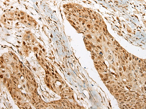 Rabbit Polyclonal Antibody to UBTF