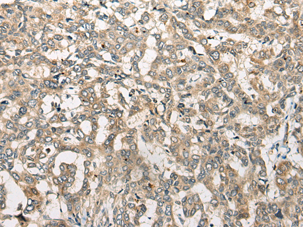 Rabbit Polyclonal Antibody to YTHDF1