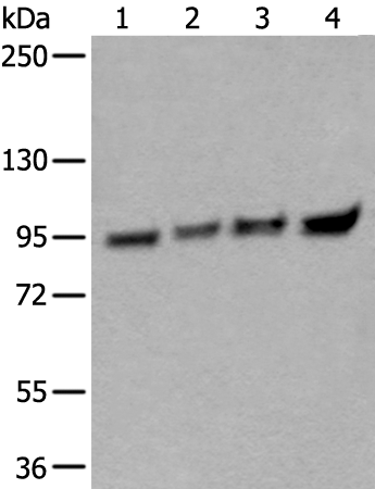 Rabbit Polyclonal Antibody to XAB2