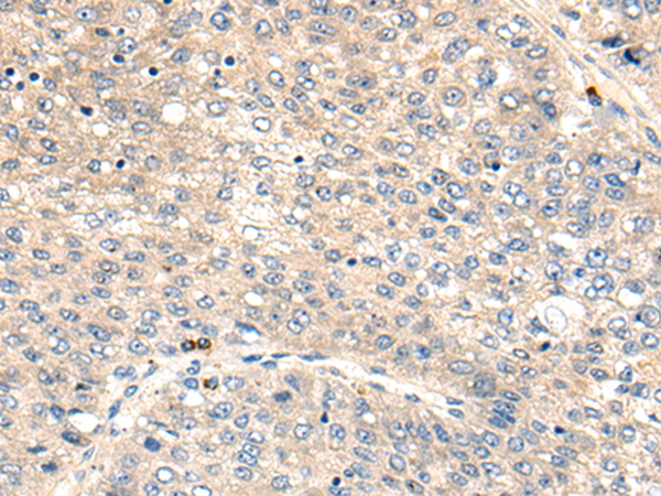 Rabbit Polyclonal Antibody to XDH