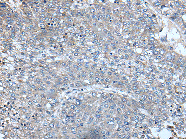 Rabbit Polyclonal Antibody to XIRP1