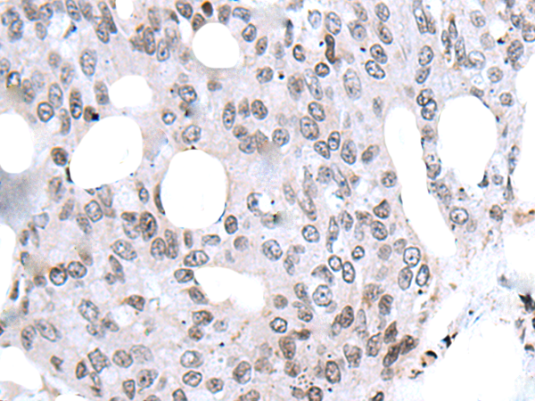 Rabbit Polyclonal Antibody to NHEJ1