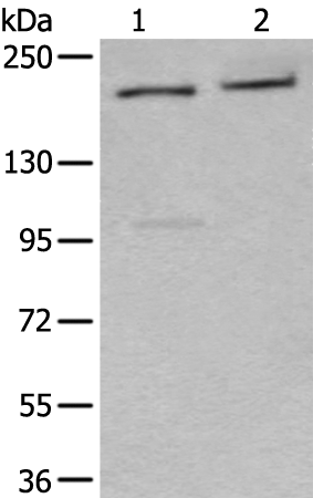 Rabbit Polyclonal Antibody to XRN1