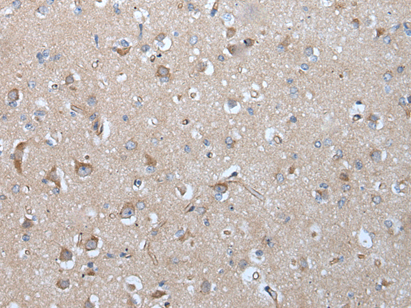 Rabbit Polyclonal Antibody to MIEN1