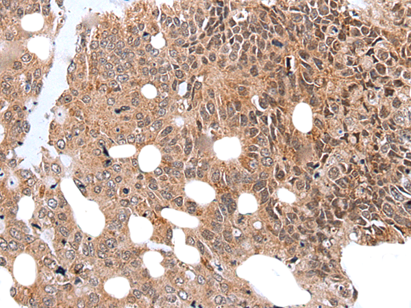 Rabbit Polyclonal Antibody to WDHD1