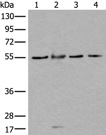 Rabbit Polyclonal Antibody to WDSUB1