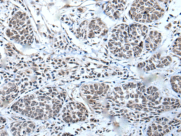 Rabbit Polyclonal Antibody to WEE1