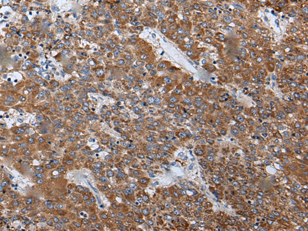 Rabbit Polyclonal Antibody to WRN
