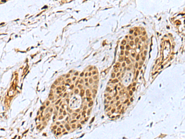 Rabbit Polyclonal Antibody to WRNIP1