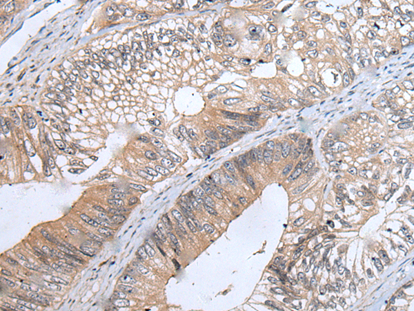 Rabbit Polyclonal Antibody to NSD2
