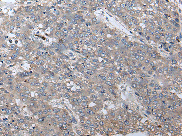 Rabbit Polyclonal Antibody to WIF1