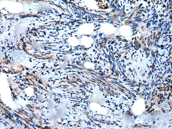 Rabbit Polyclonal Antibody to WIPF1