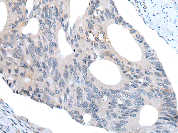 Rabbit Polyclonal Antibody to WIPF2