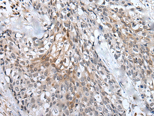 Rabbit Polyclonal Antibody to SUN5