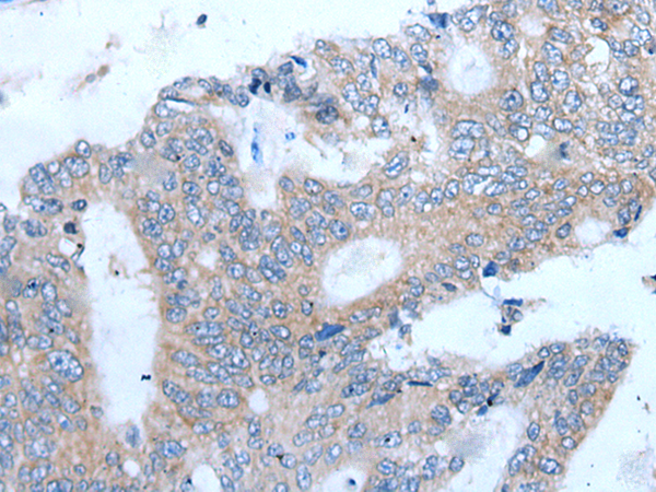 Rabbit Polyclonal Antibody to CCN5
