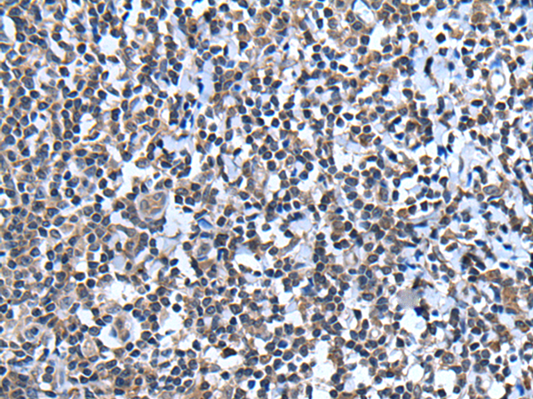 Rabbit Polyclonal Antibody to CCN6