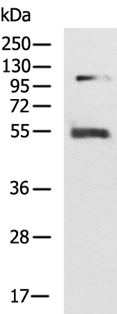 Rabbit Polyclonal Antibody to WNT5A