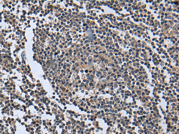 Rabbit Polyclonal Antibody to WNT9B