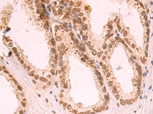 Rabbit Polyclonal Antibody to VAX1