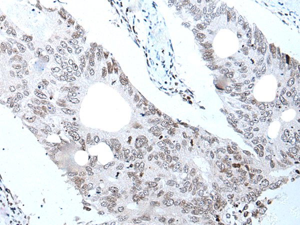 Rabbit Polyclonal Antibody to VCX