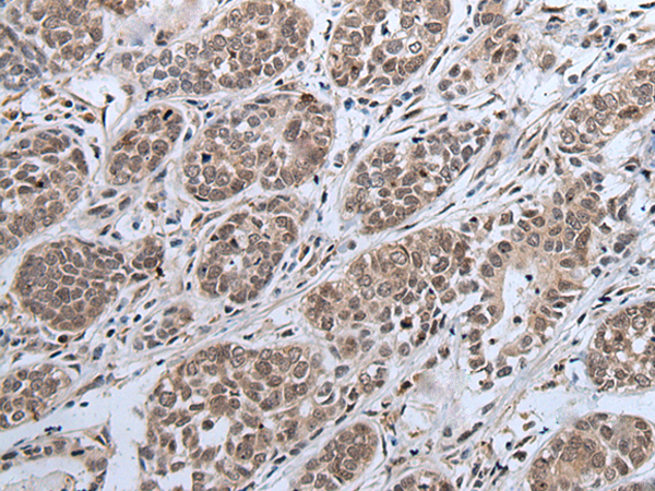 Rabbit Polyclonal Antibody to IWS1