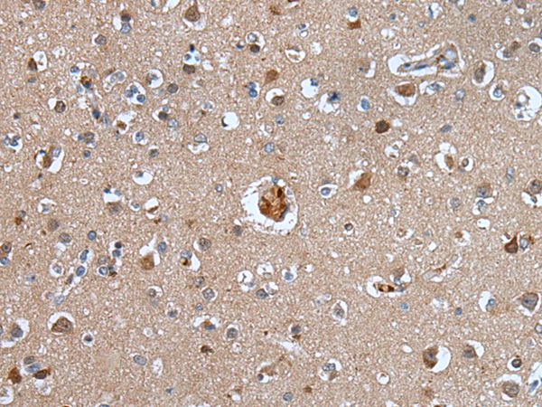 Rabbit Polyclonal Antibody to FLT4