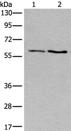 Rabbit Polyclonal Antibody to SLC17A8