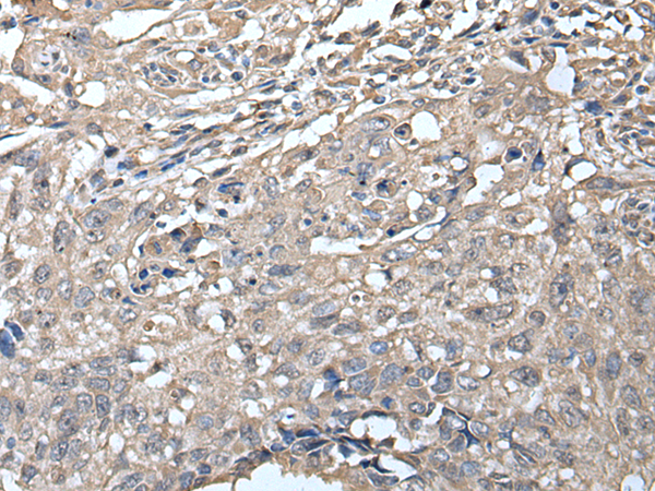 Rabbit Polyclonal Antibody to VPREB1
