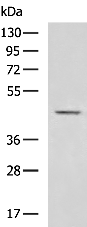 Rabbit Polyclonal Antibody to VPS36