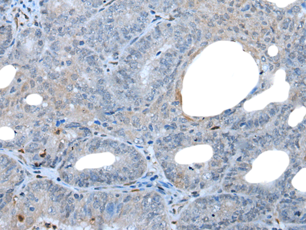 Rabbit Polyclonal Antibody to VSIG1