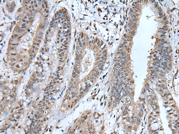 Rabbit Polyclonal Antibody to UBA52