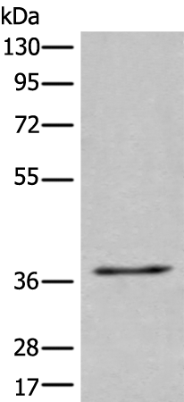 Rabbit Polyclonal Antibody to UBAC2