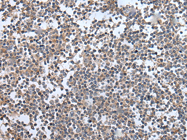 Rabbit Polyclonal Antibody to UBE4B