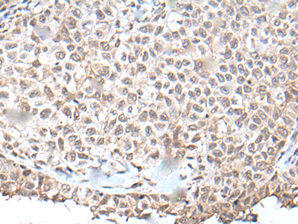 Rabbit Polyclonal Antibody to UBN1