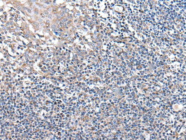 Rabbit Polyclonal Antibody to UBN2
