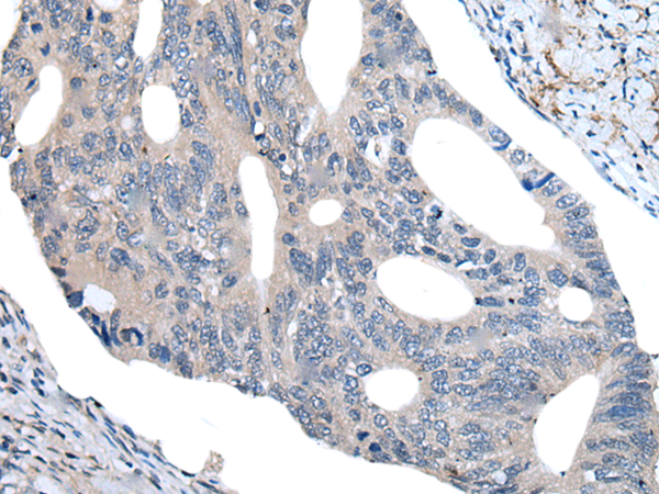 Rabbit Polyclonal Antibody to UBR4