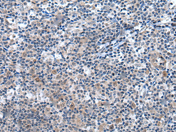 Rabbit Polyclonal Antibody to UCK2