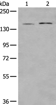 Rabbit Polyclonal Antibody to ERBB2