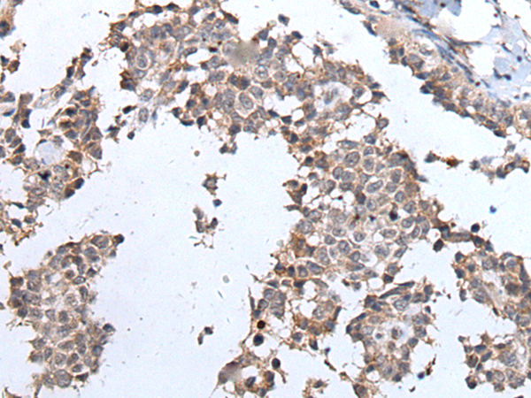 Rabbit Polyclonal Antibody to ERBB4