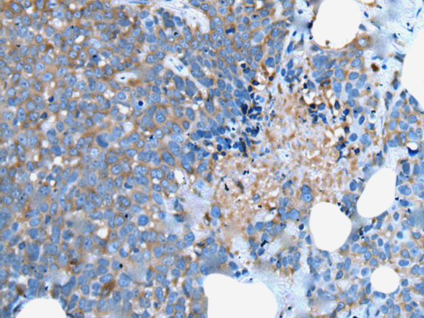 Rabbit Polyclonal Antibody to UGT2B15