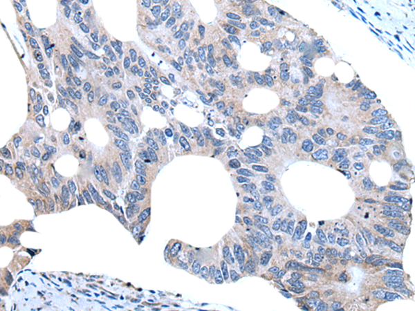 Rabbit Polyclonal Antibody to UGT8