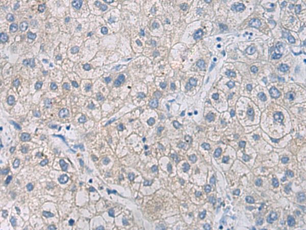 Rabbit Polyclonal Antibody to ULK2