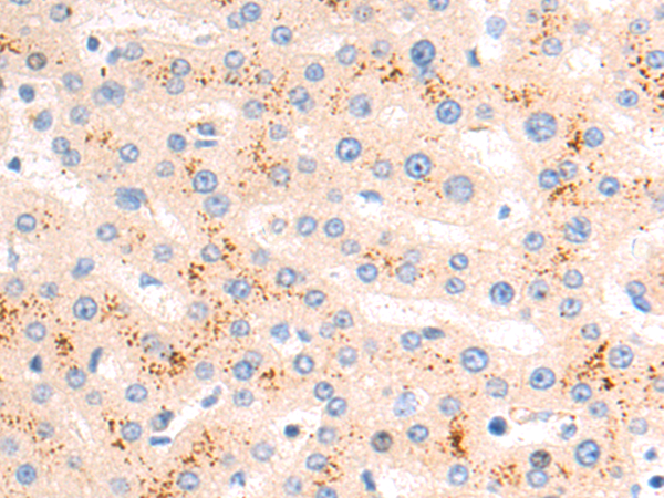 Rabbit Polyclonal Antibody to UNC5B