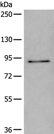 Rabbit Polyclonal Antibody to UNC5A