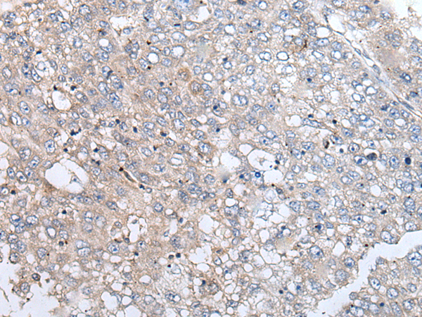 Rabbit Polyclonal Antibody to URGCP