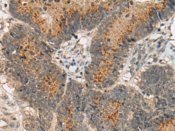 Rabbit Polyclonal Antibody to USP32