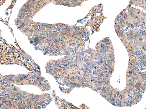 Rabbit Polyclonal Antibody to USP37