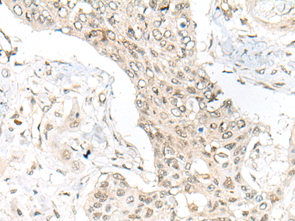 Rabbit Polyclonal Antibody to ASXL1